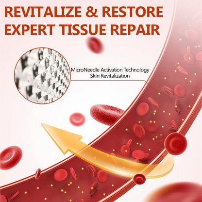 🔥 LIMITED SPECIAL OFFER🔥Acezozla® VeinRepair Microneedle Patch Roll (Advanced Microneedle Vein Repair Patch for Bulging Veins, Swelling, Heavy Legs & Daily Leg Discomfort)