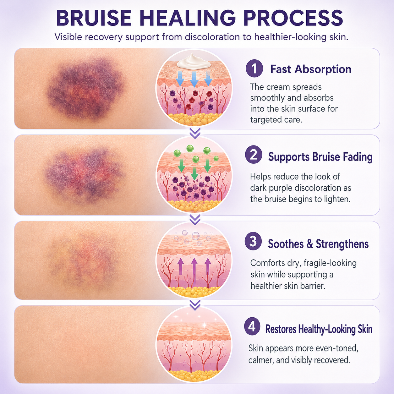 Bruise Fade Pro™ Advanced Bruise Recovery Cream – Arnica & Vitamin K Skin Repair Formula