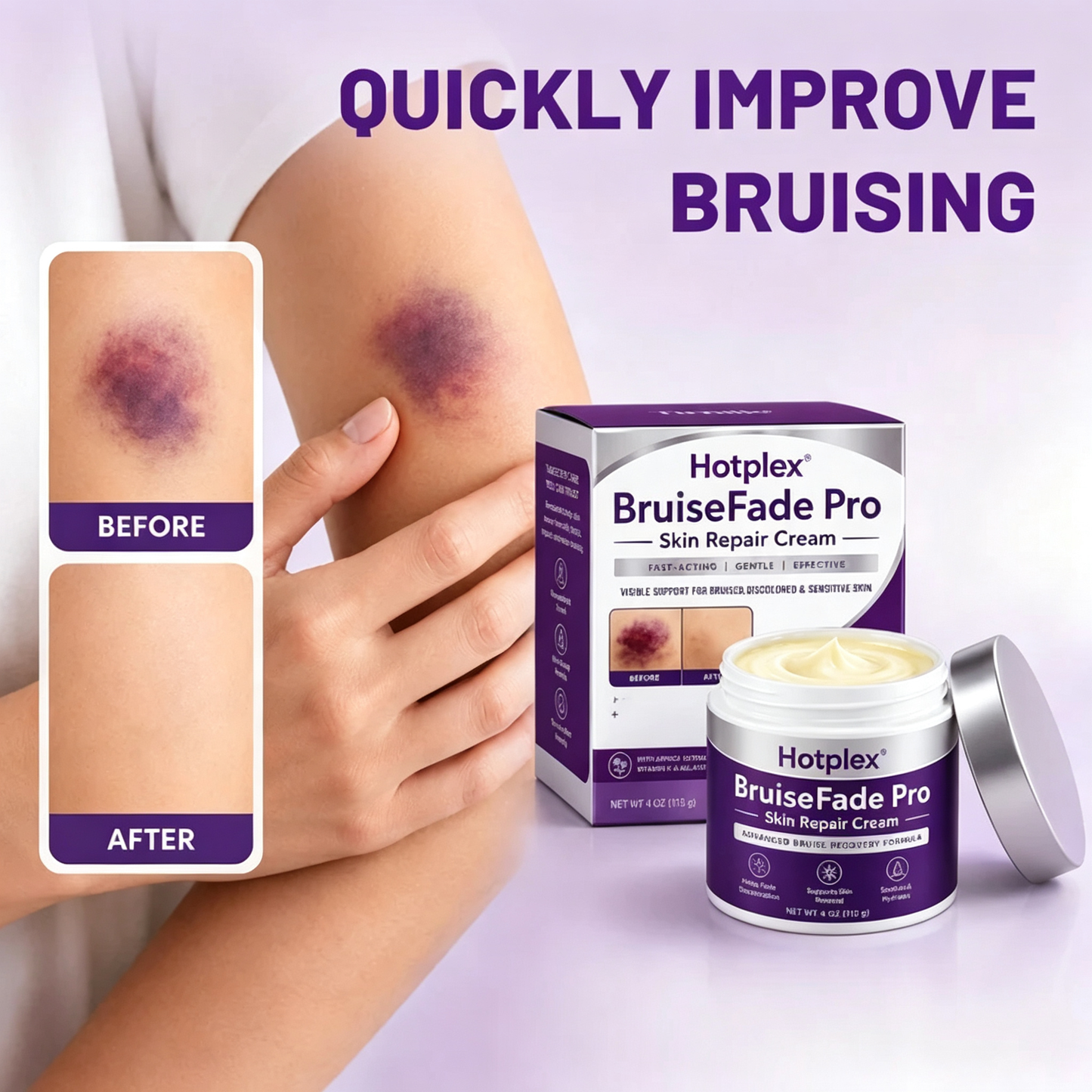 Bruise Fade Pro™ Advanced Bruise Recovery Cream – Arnica & Vitamin K Skin Repair Formula