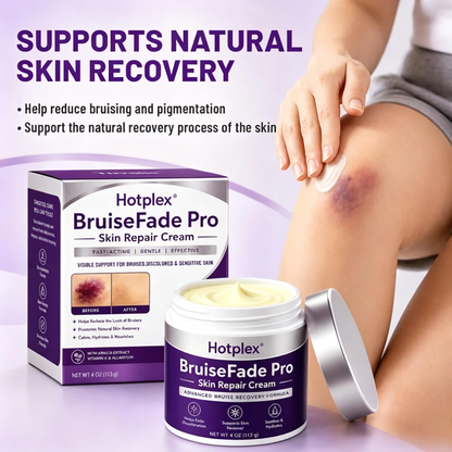 Bruise Fade Pro™ Advanced Bruise Recovery Cream – Arnica & Vitamin K Skin Repair Formula