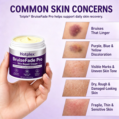 Bruise Fade Pro™ Advanced Bruise Recovery Cream – Arnica & Vitamin K Skin Repair Formula