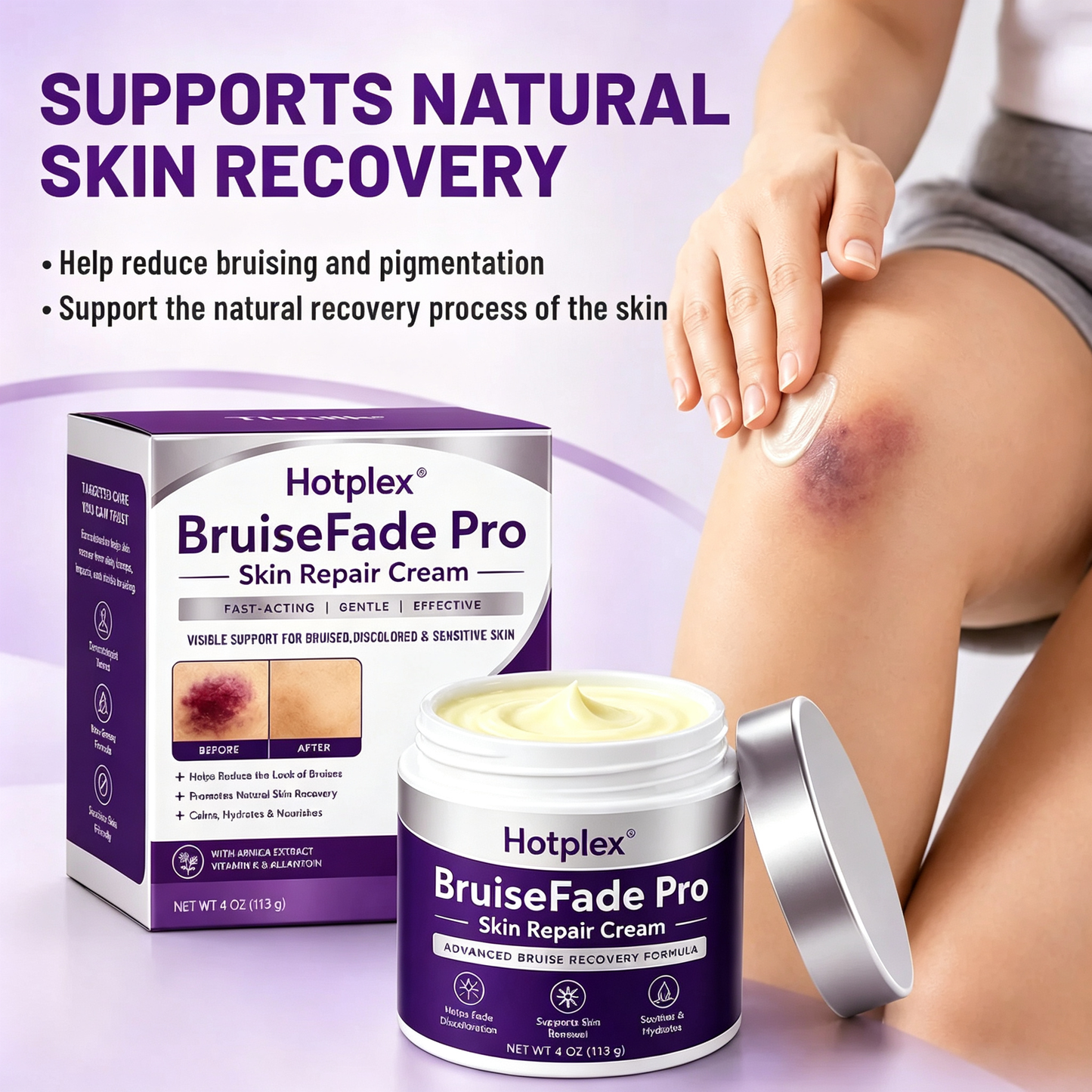 Bruise Fade Pro™ Advanced Bruise Recovery Cream – Arnica & Vitamin K Skin Repair Formula