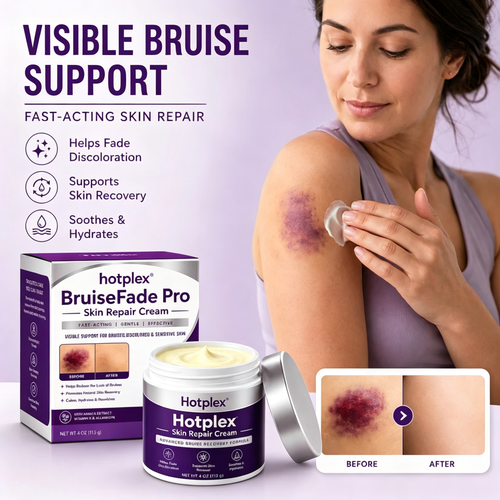 Bruise Fade Pro™ Advanced Bruise Recovery Cream – Arnica & Vitamin K Skin Repair Formula